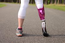 Friends supported a girl with a prosthetic